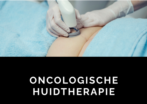 ONCOLOGISCHE HUIDTHERAPIE