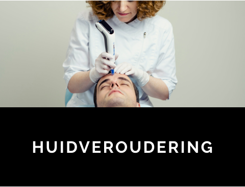 HUIDVEROUDERING